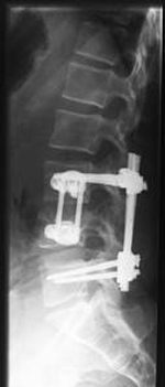 Röntgenbild-Polytrauma